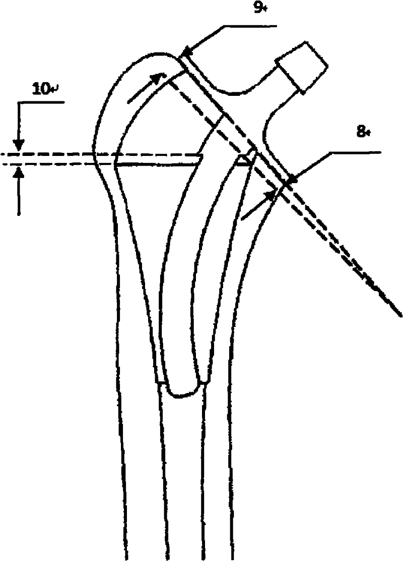 Artificial femoral prosthesis