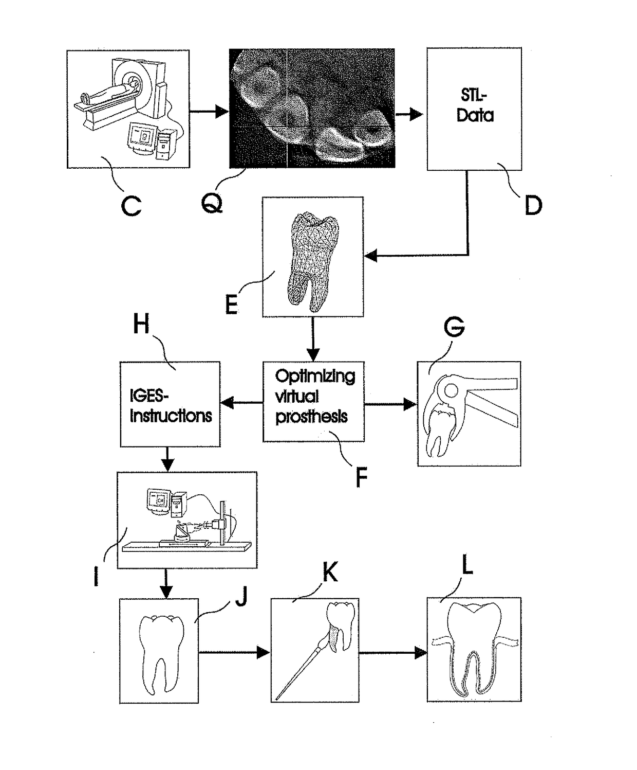 Methods of Designing and Manufacturing Customized Dental Prosthesis For Periodontal or Osseointegration and Related Systems