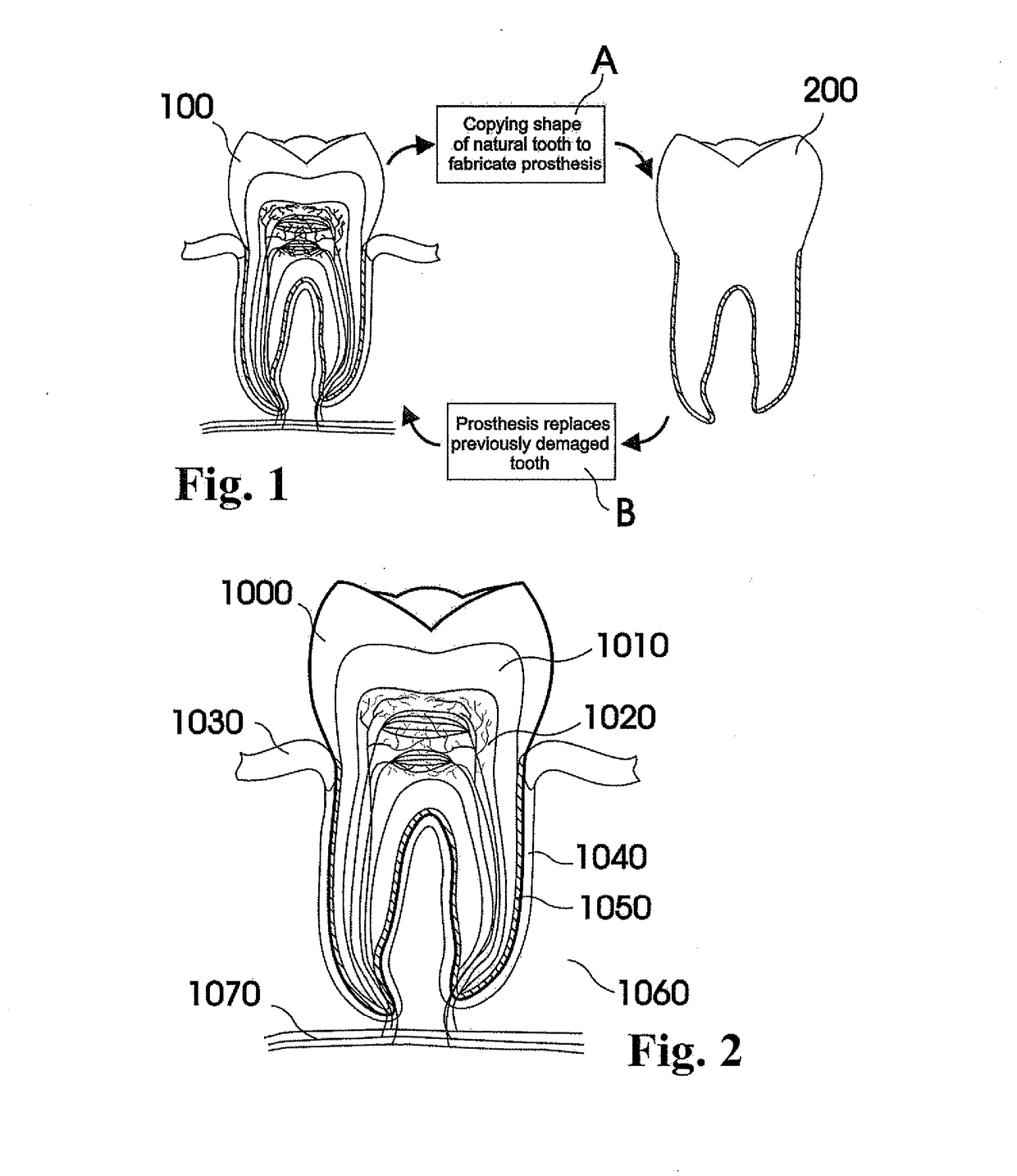 Methods of Designing and Manufacturing Customized Dental Prosthesis For Periodontal or Osseointegration and Related Systems