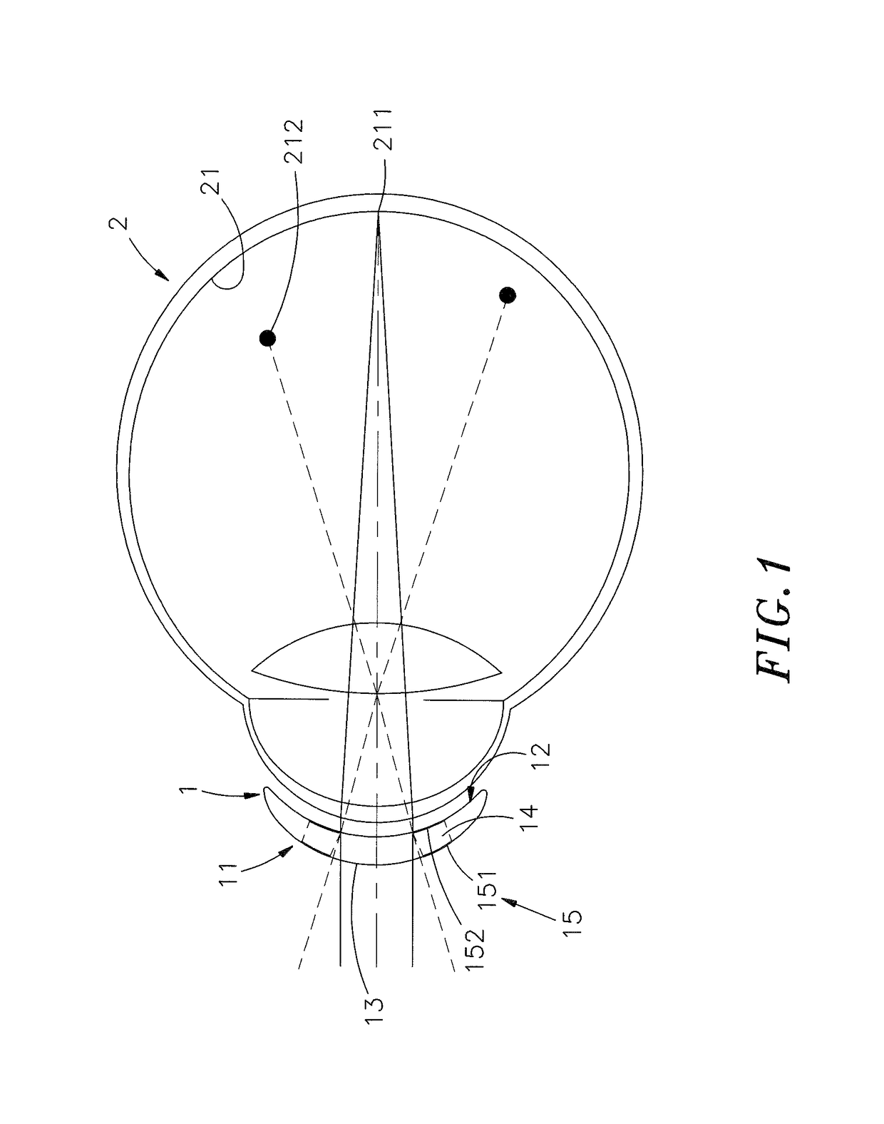 Contact lens having a moiré structure, contact lens moiré structure processing method