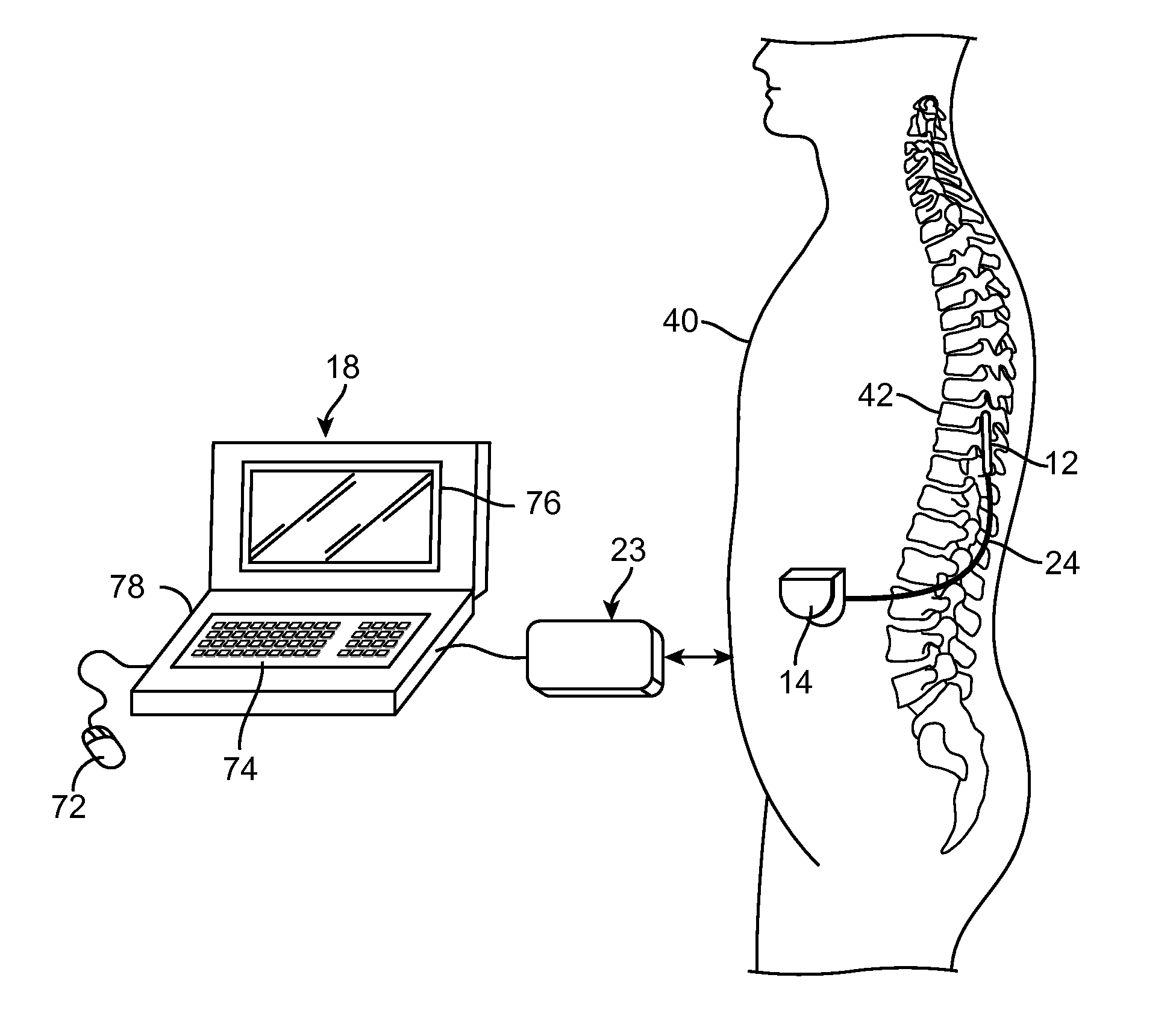 System and method for programming neurostimulation devices using cached plug-in software drivers