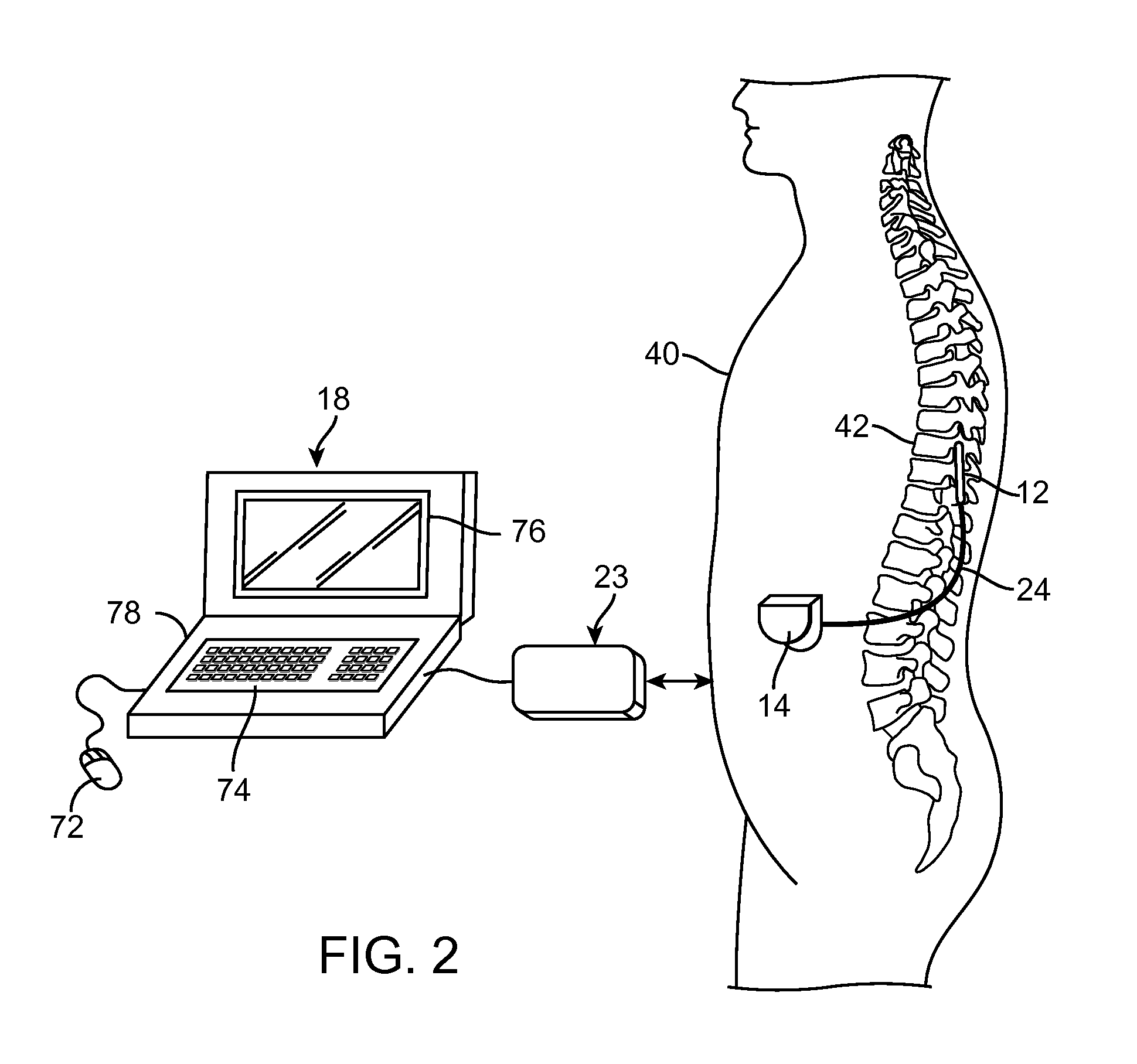 System and method for programming neurostimulation devices using cached plug-in software drivers