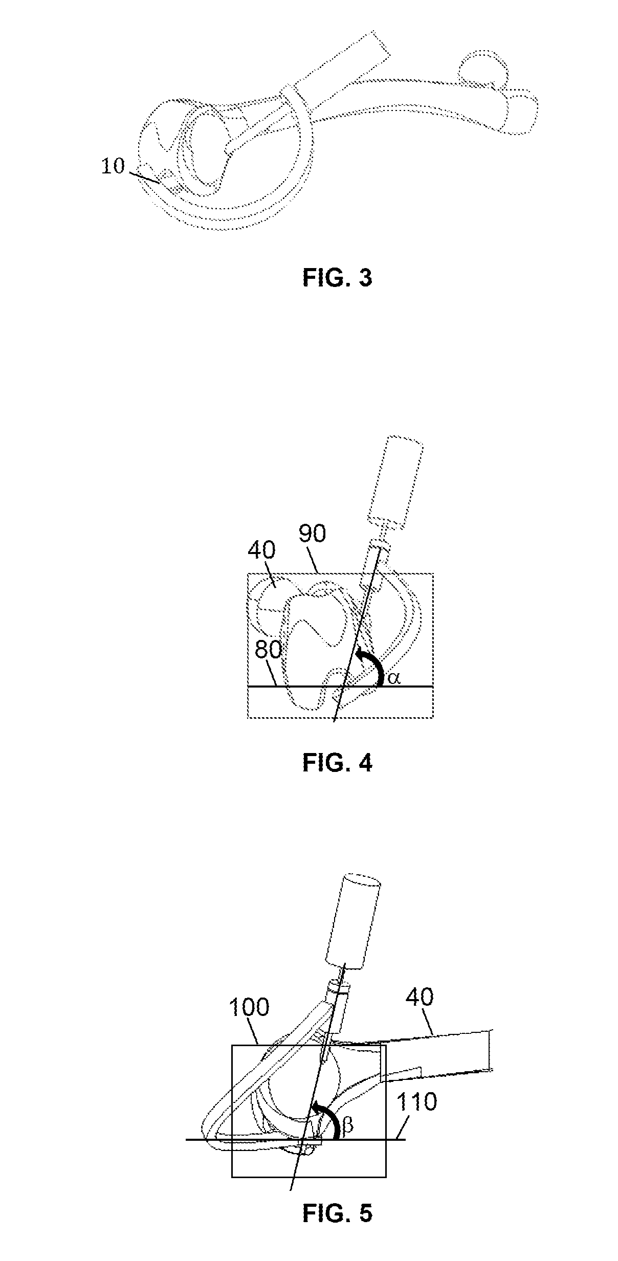 3-d femur orthopedic drill guide