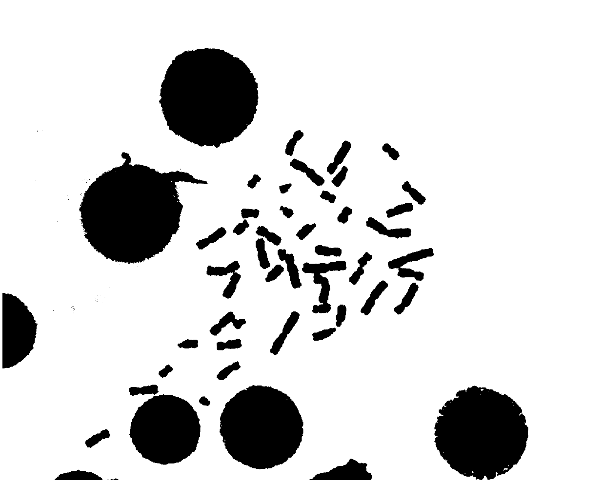A denoising method for a chromosome G banding mid-term gray level image
