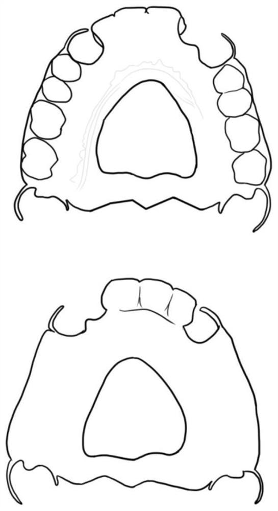 Digital all-in-one guide plate for odontoless jaw implantation and manufacturing method thereof