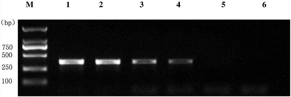 Detection primer, kit and detection method for wolbachia in brown planthopper