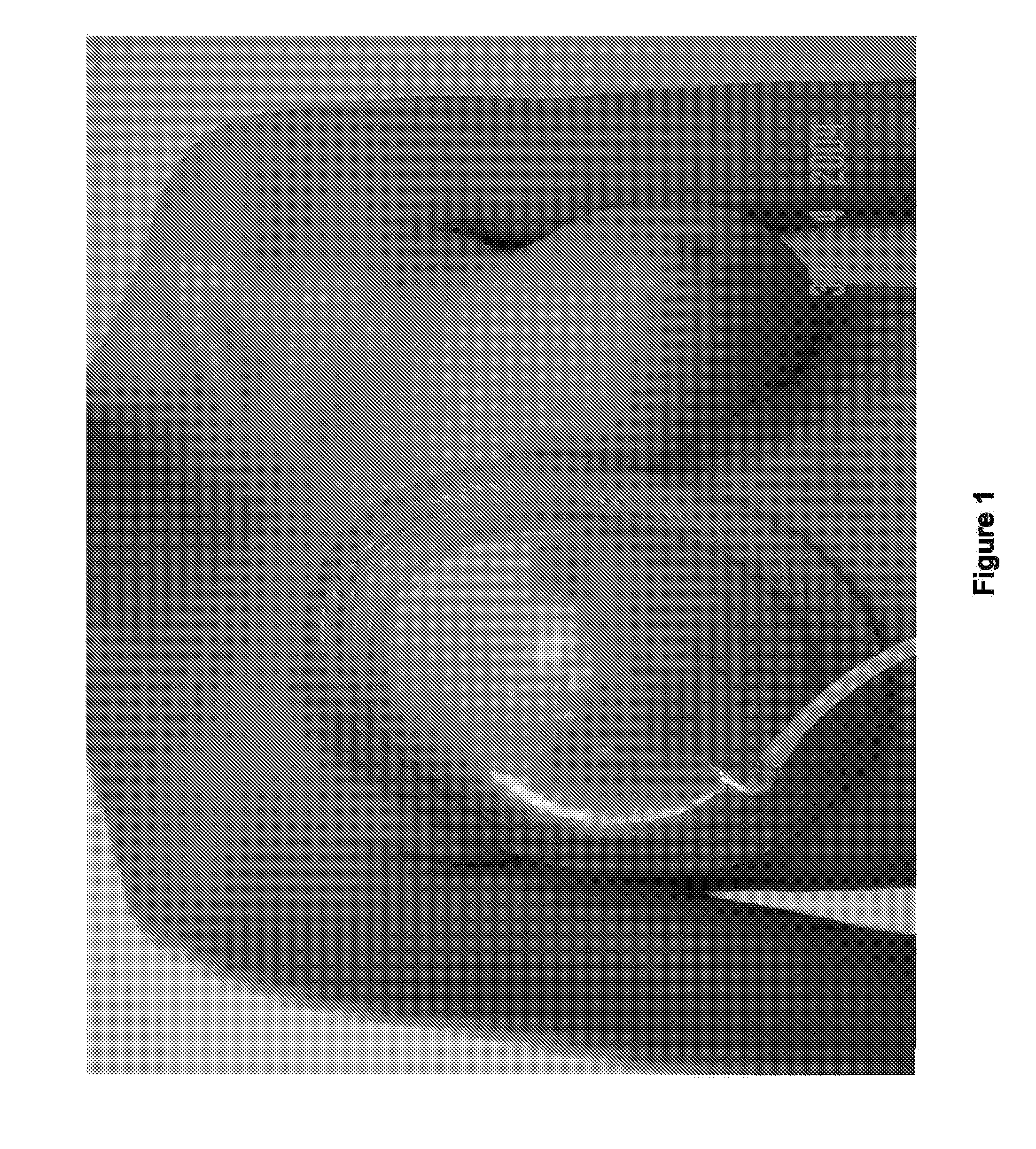 Method and system for preparing soft tissue for grafting, enhancing grafting results, and grafting autologous fat to soft tissue such as the breast