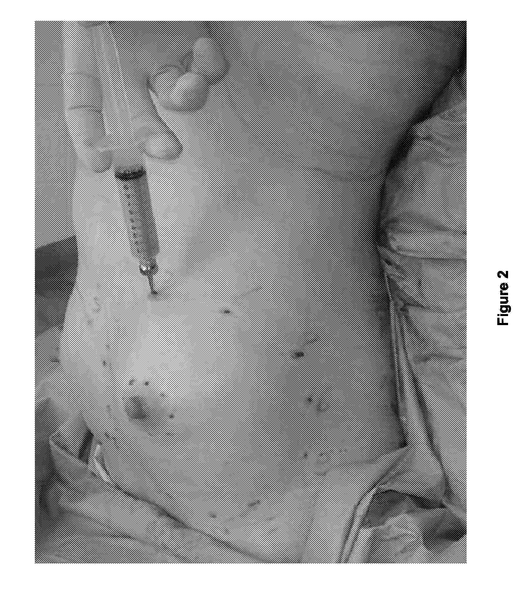 Method and system for preparing soft tissue for grafting, enhancing grafting results, and grafting autologous fat to soft tissue such as the breast