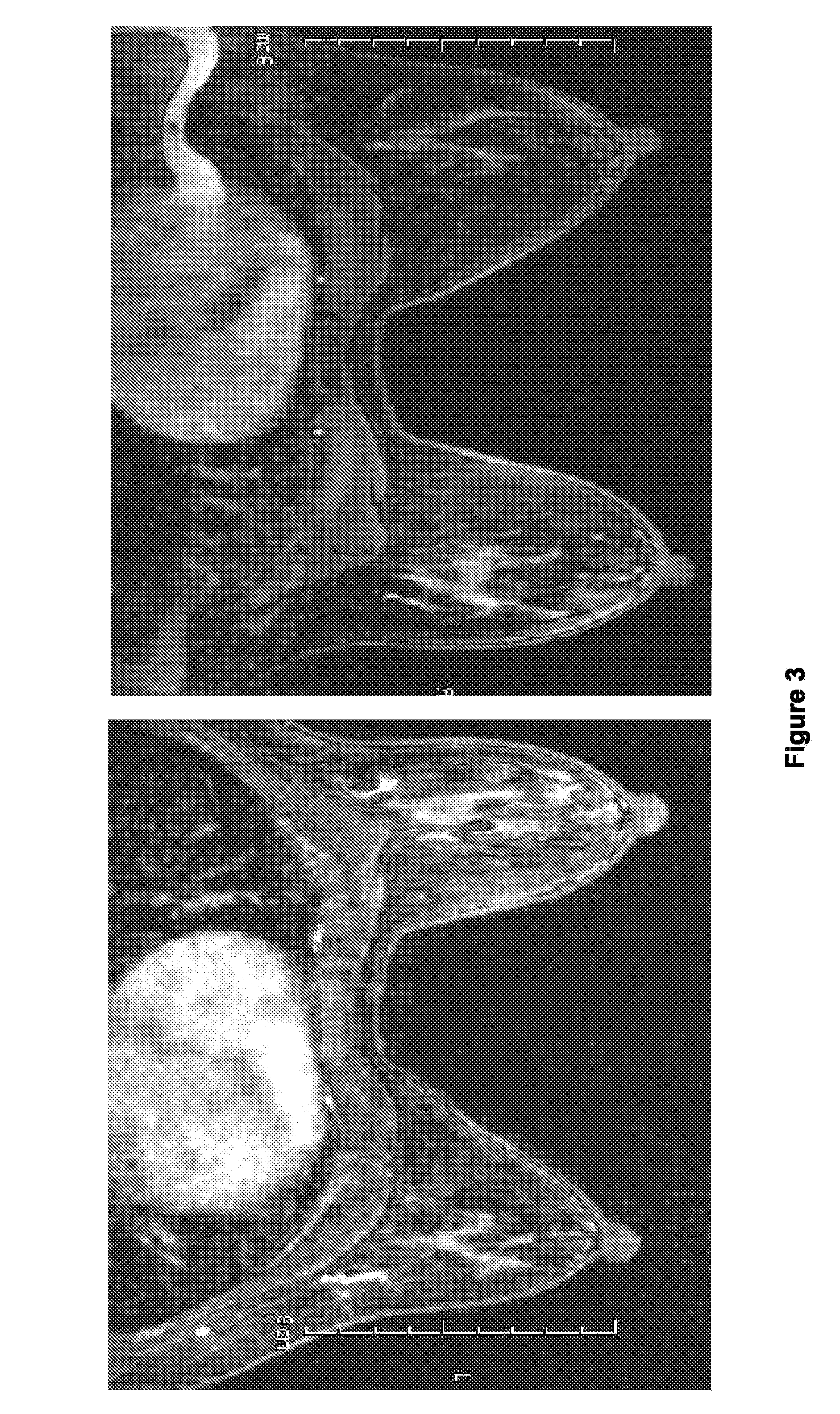 Method and system for preparing soft tissue for grafting, enhancing grafting results, and grafting autologous fat to soft tissue such as the breast