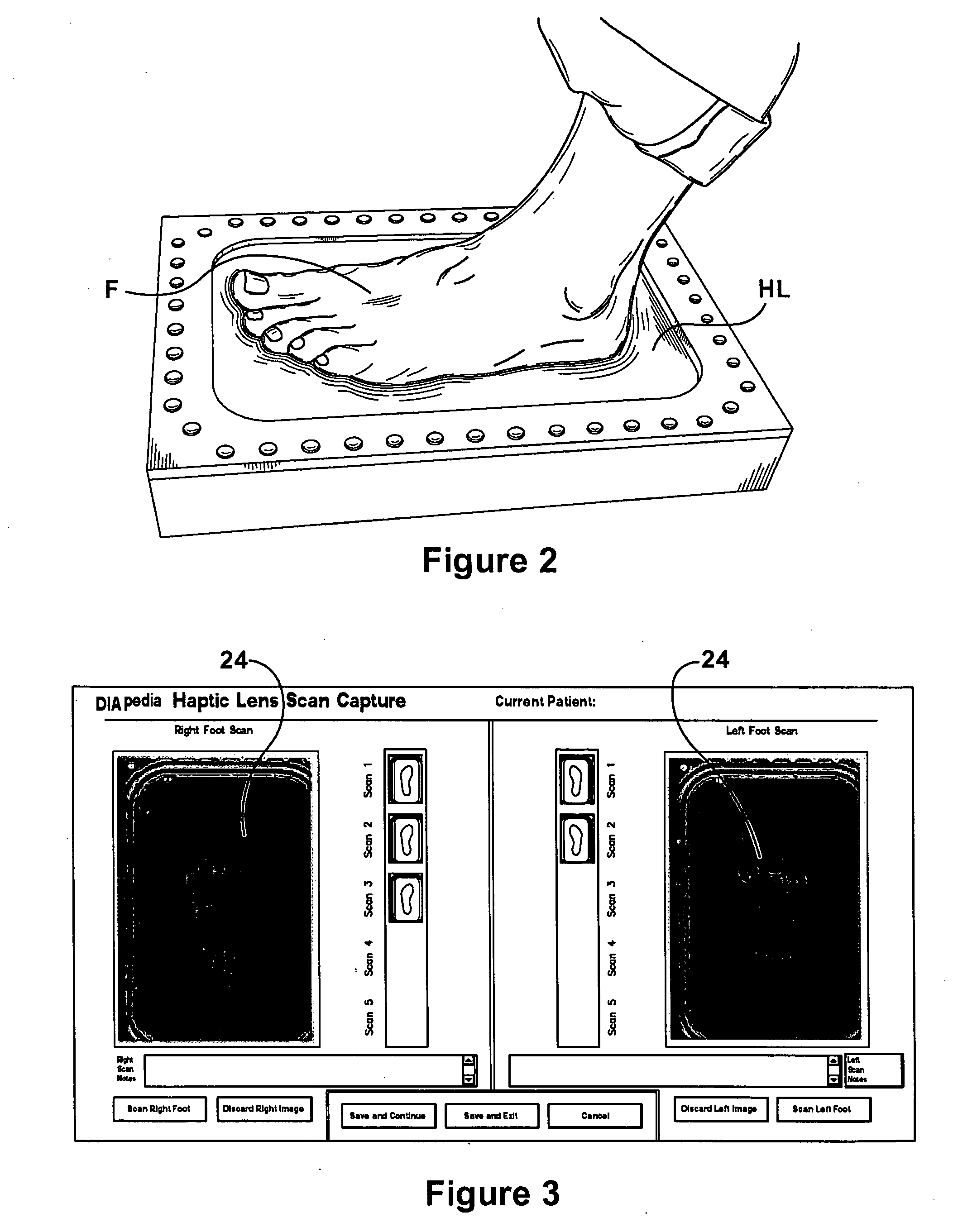 Method for design and manufacture of insoles