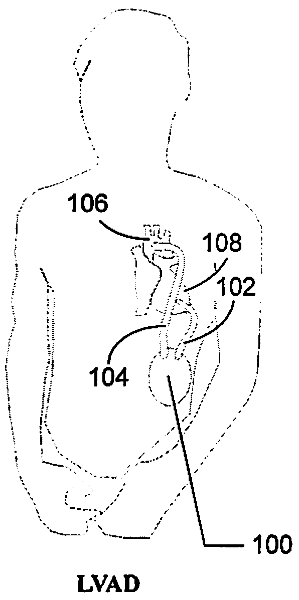 Device and method for connecting a blood pump without trapping air bubbles