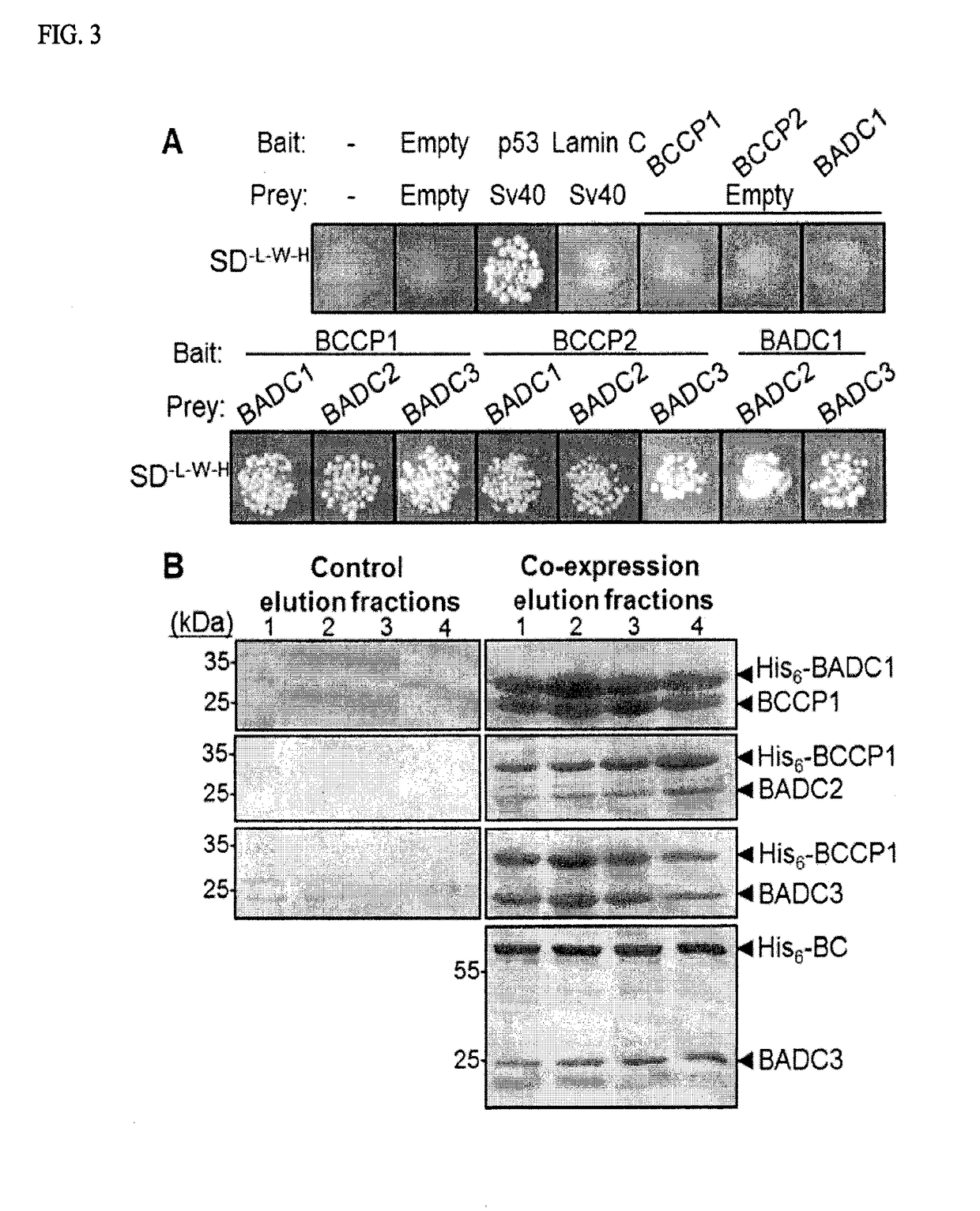 Increasing plant oil content by altering a negative regulator of acetyl-coa carboxylase
