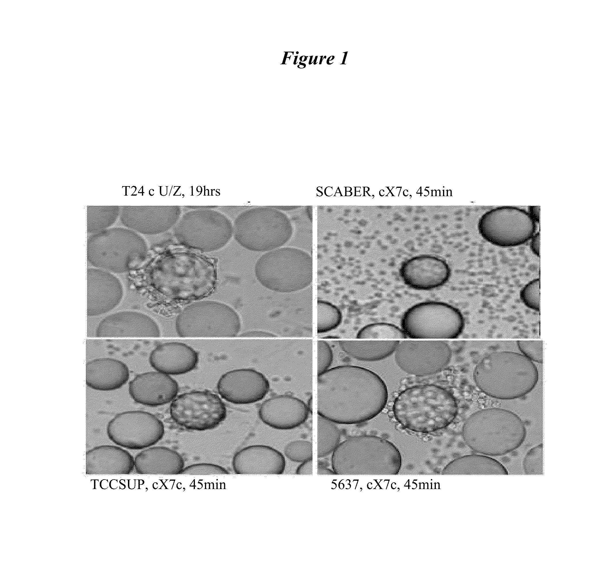 Bladder cancer specific ligand peptides