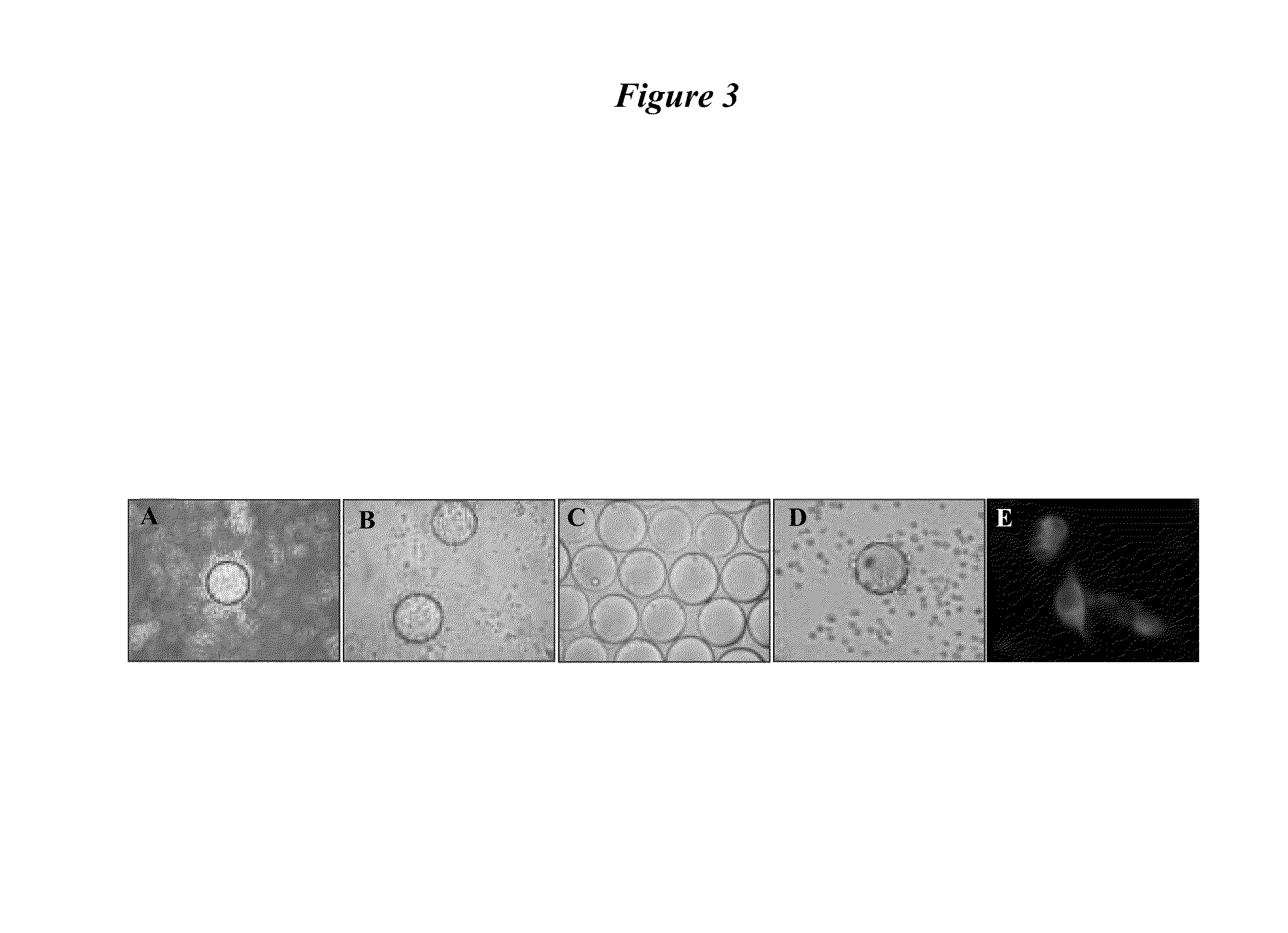 Bladder cancer specific ligand peptides