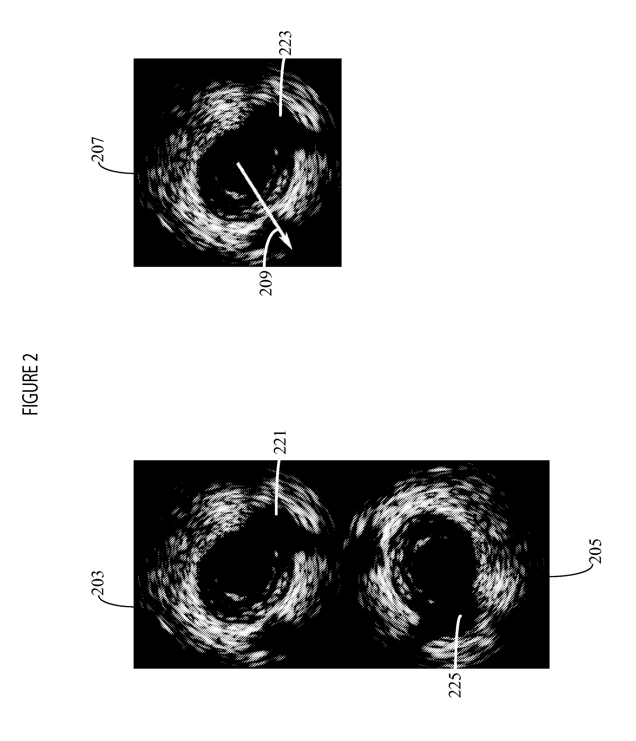 System for Orientation and Display of Ultrasound Imaging Data