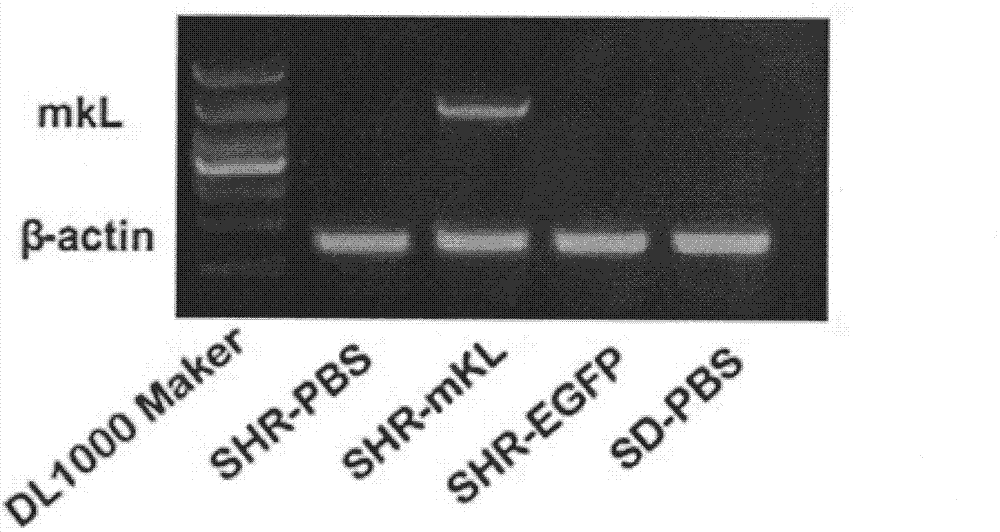 Application of Klotho adeno-associated virus to preparation of medicine for treating hypertensive heart disease of spontaneous hypertensive rat (SHR)