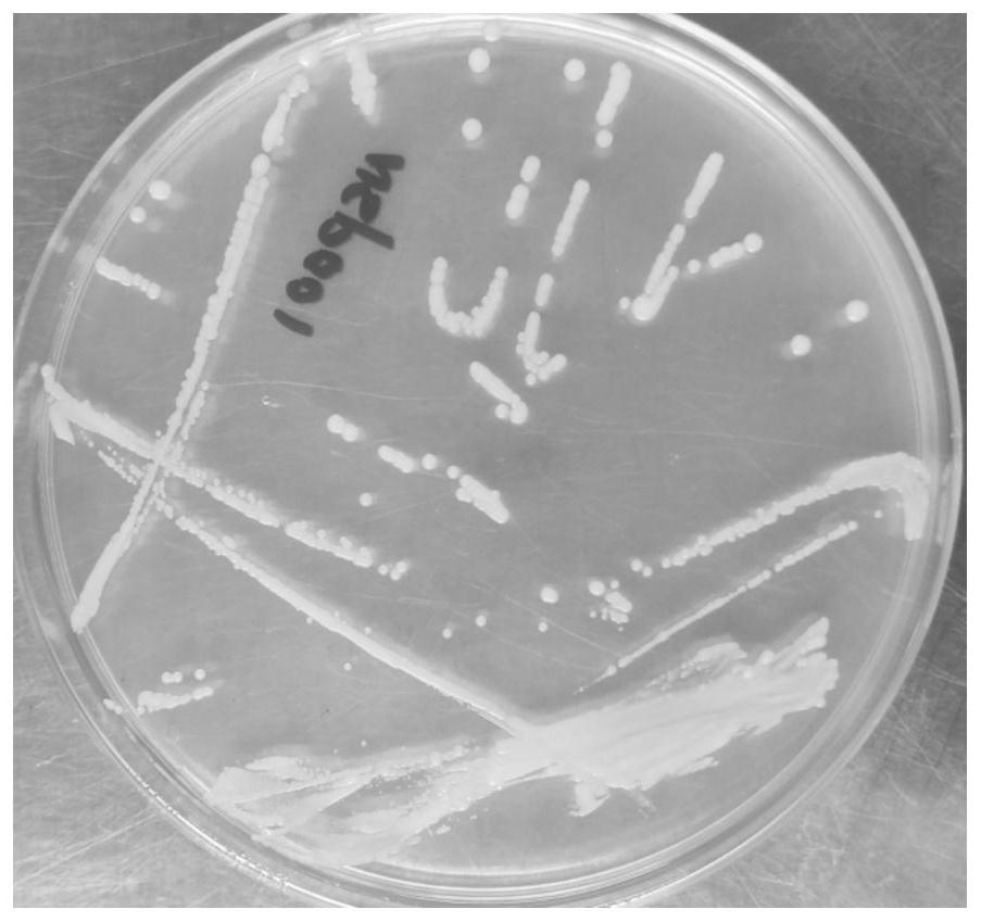 Bifidobacterium longum for relieving ulcerative colitis and application thereof