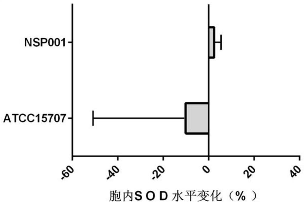 Bifidobacterium longum for relieving ulcerative colitis and application thereof