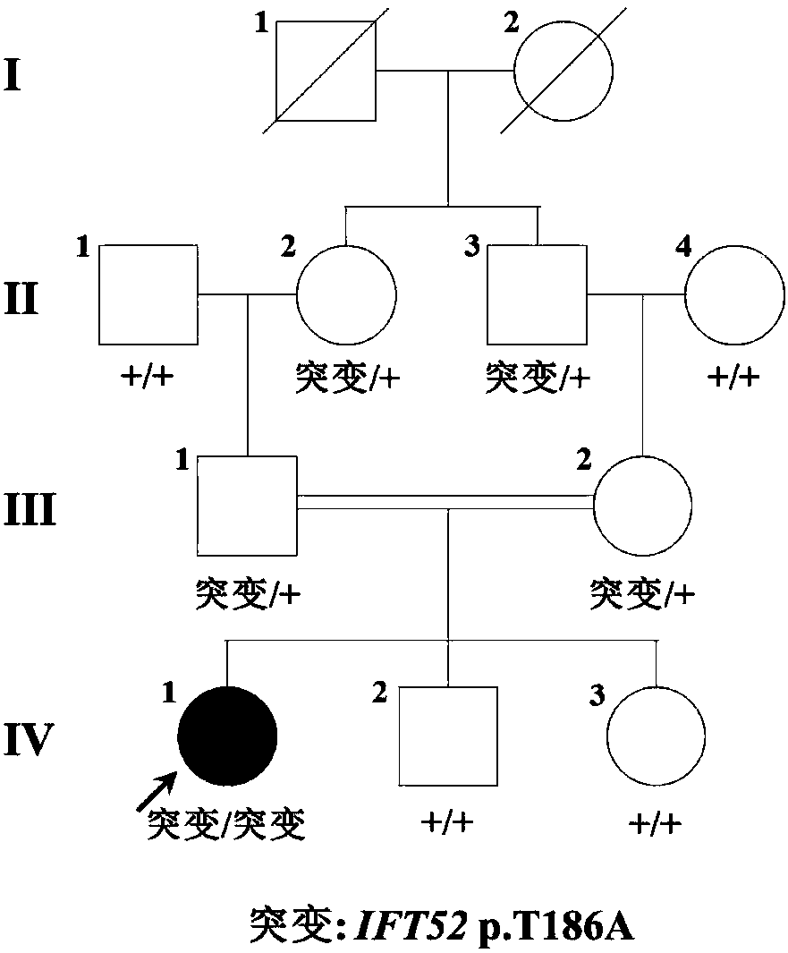 Leber's congenital amaurosis pathopoiesia mutation and detection reagent thereof