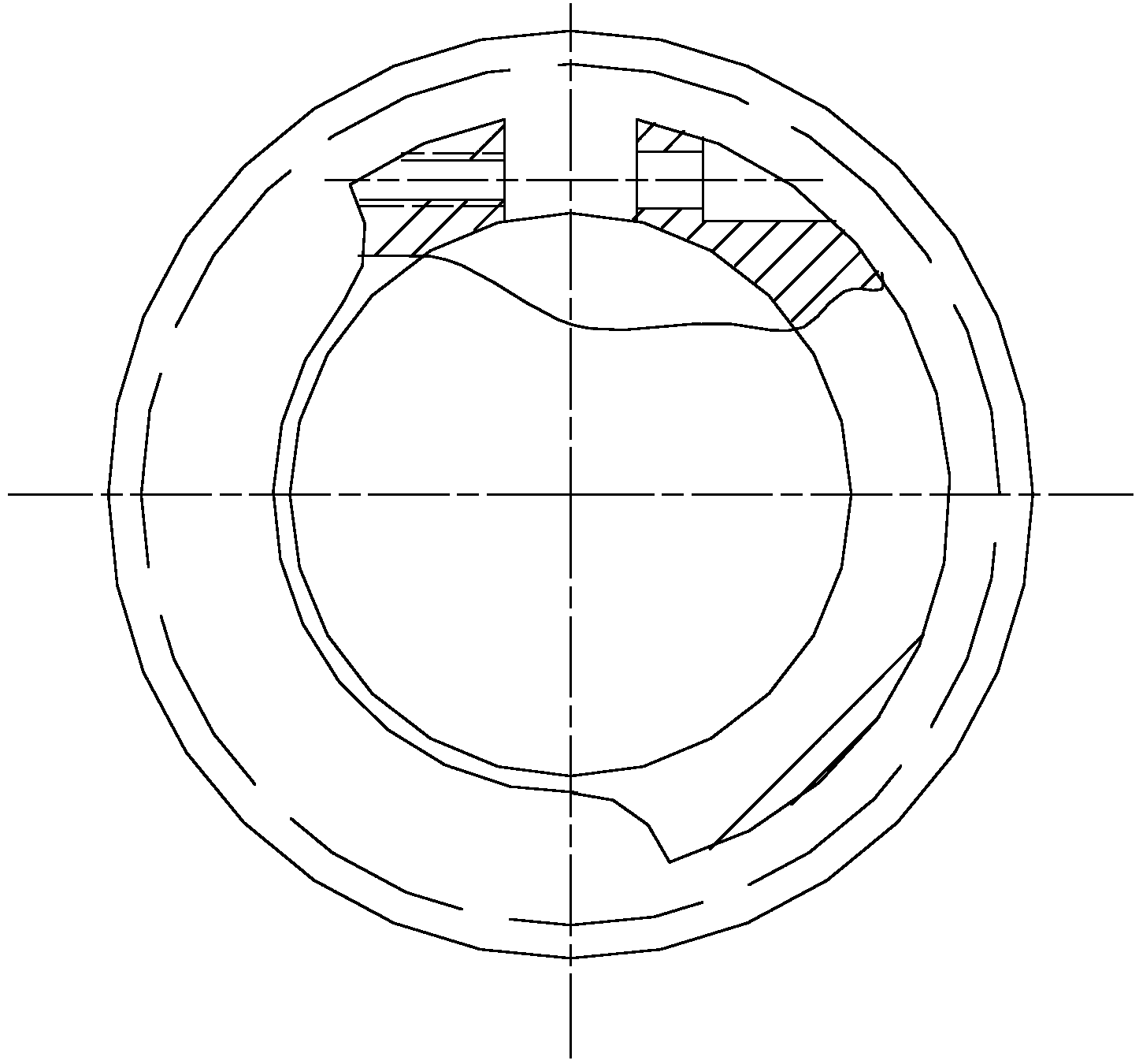 Suture ring for left ventricle