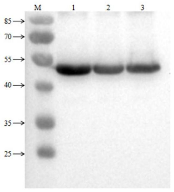 CK20 antigen, hybridoma cell strain, monoclonal antibody, and application thereof