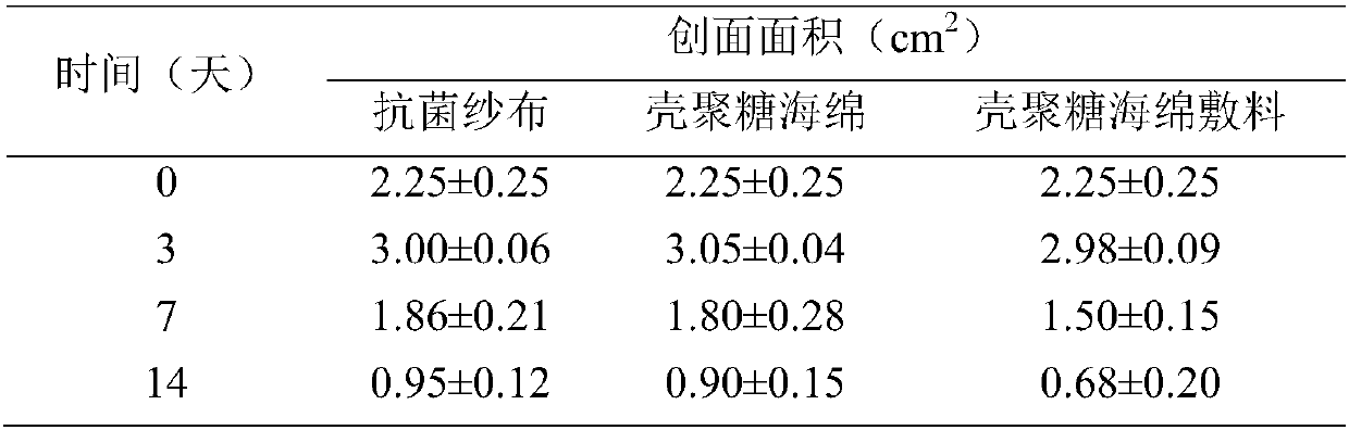 Preparation method of double-layer type water-proof, anti-bacterial and anti-cicatricial chitosan sponge dressing