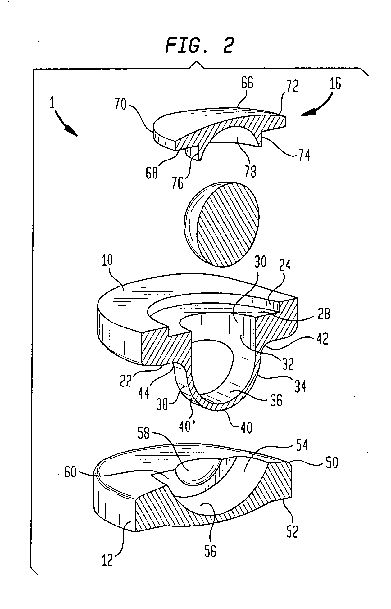 Artificial intervertebral disc having a universal joint