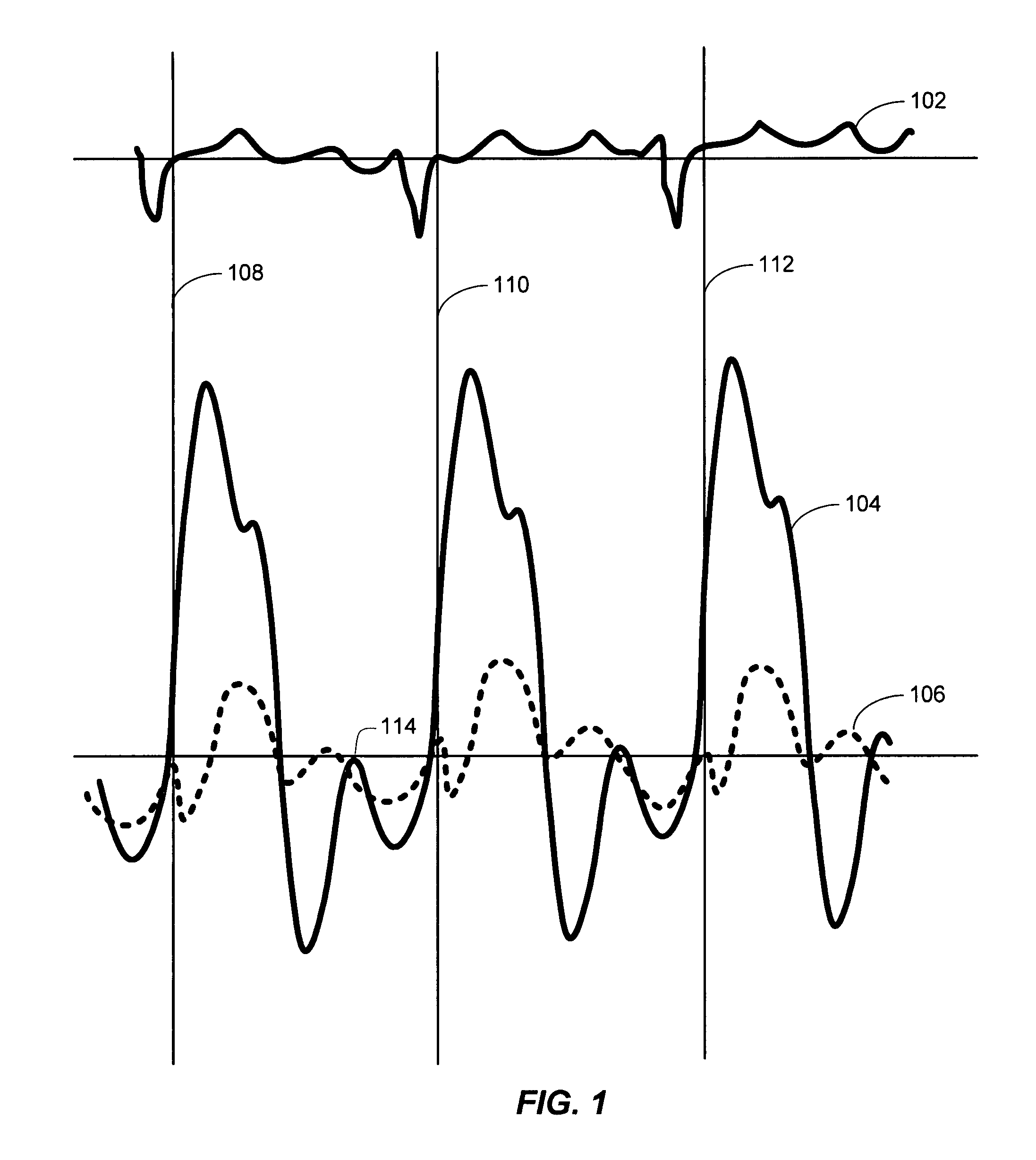 Method, apparatus, and system to optimize cardiac preload based on measured pulmonary artery pressure