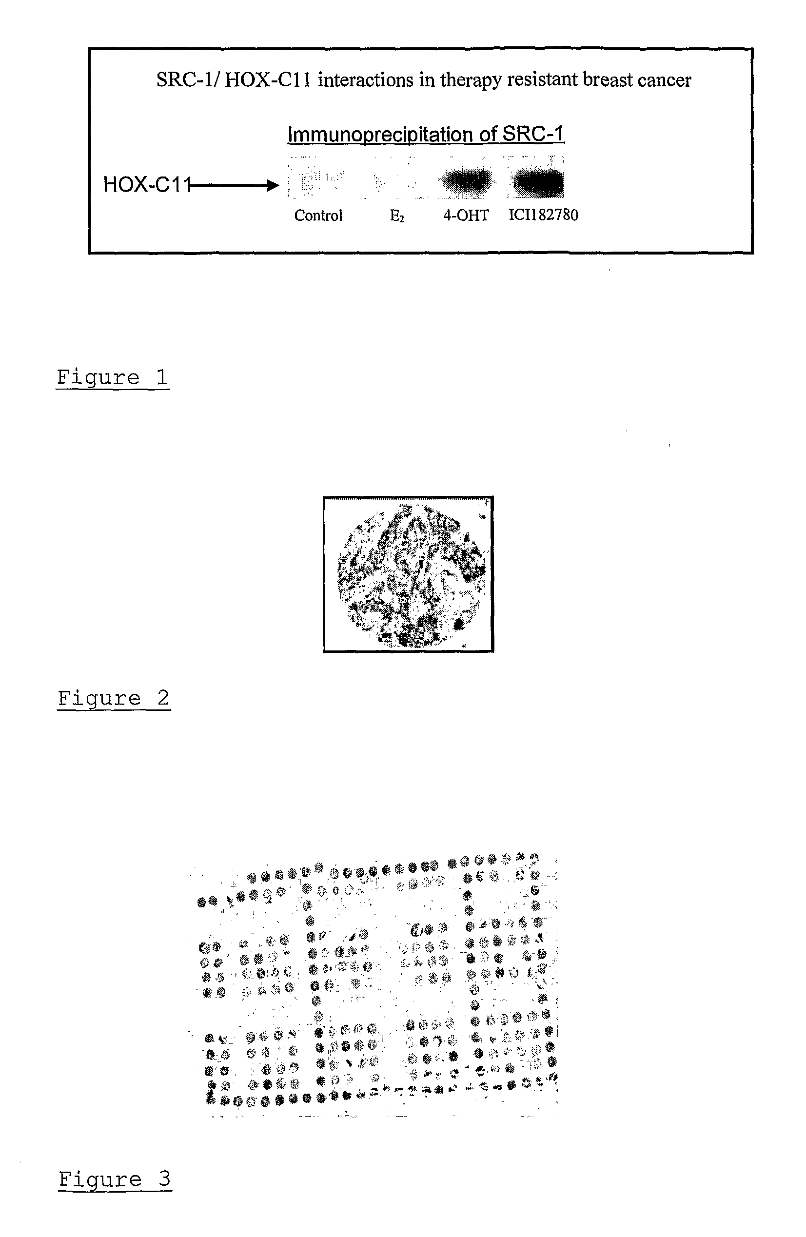 Method of assessing cancer status in a breast cancer patient