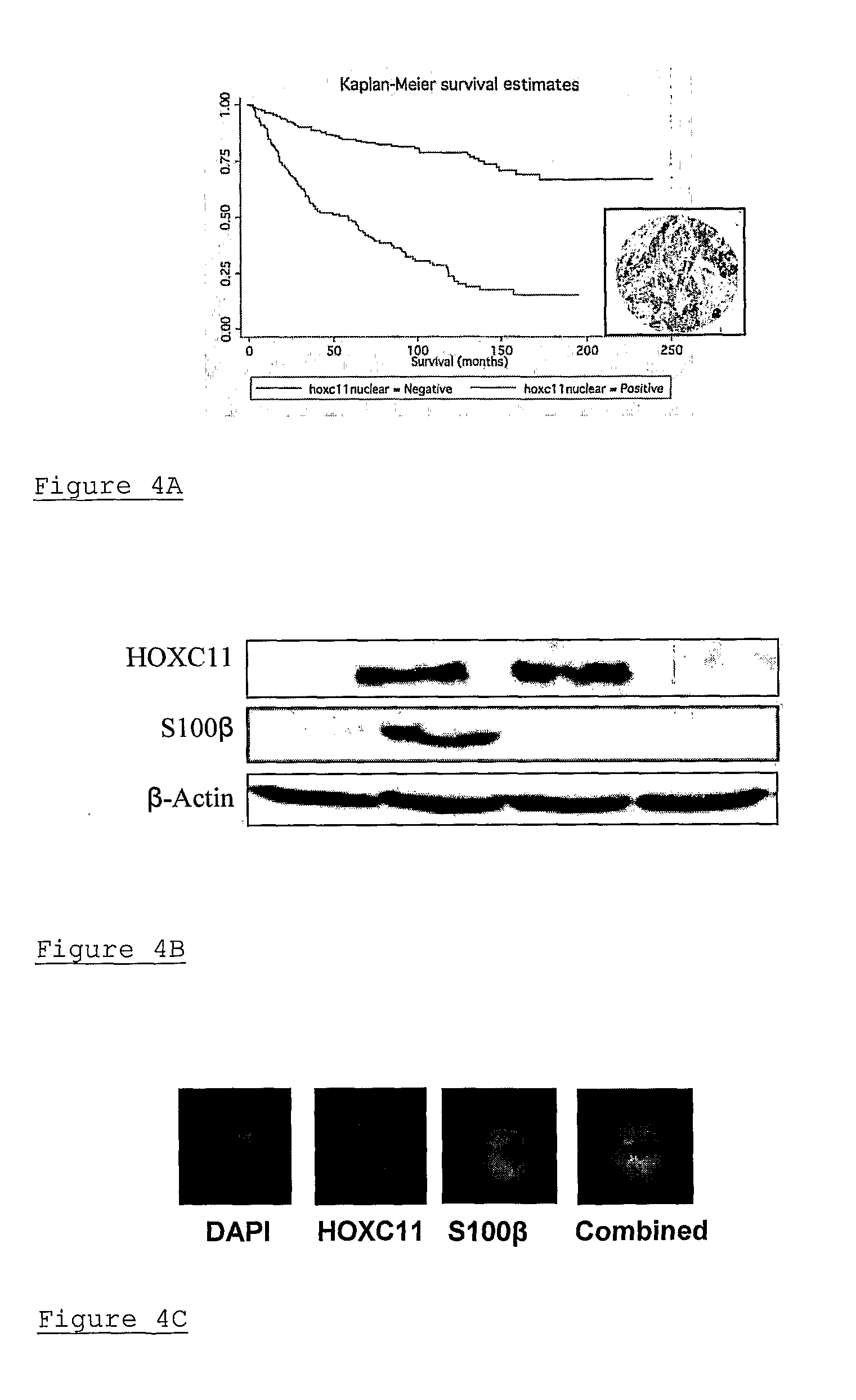 Method of assessing cancer status in a breast cancer patient