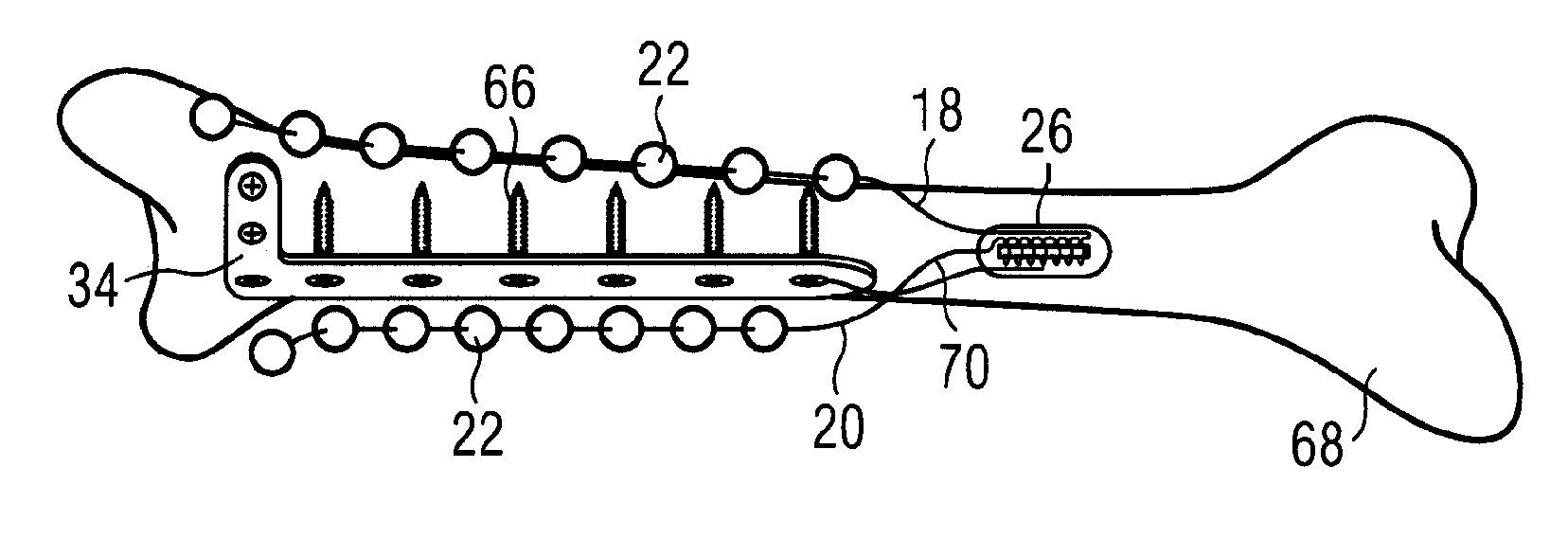 Device for Administering Drugs and for Influencing the Effects of Drugs
