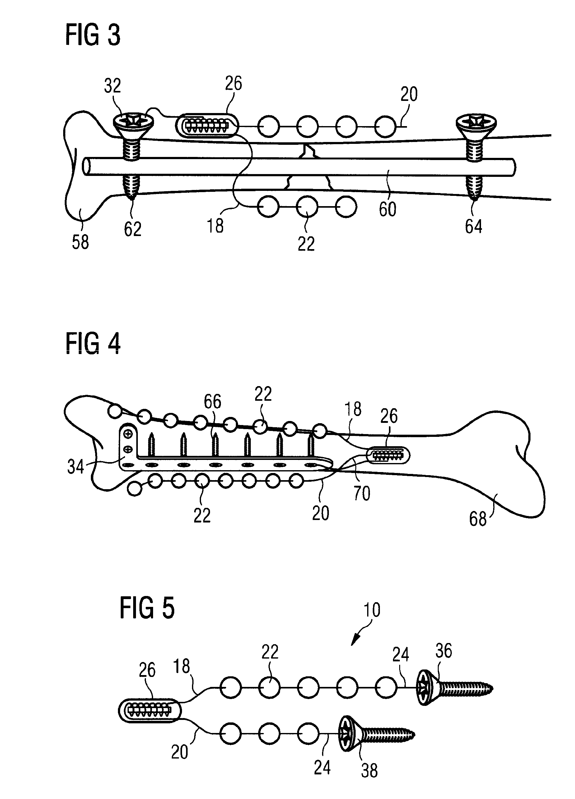 Device for Administering Drugs and for Influencing the Effects of Drugs
