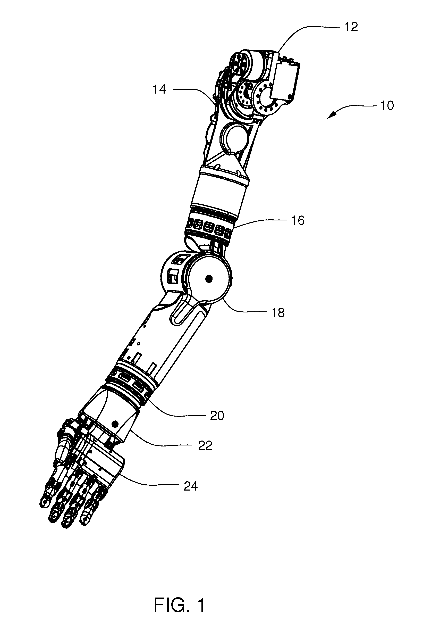 Arm Prosthetic Device