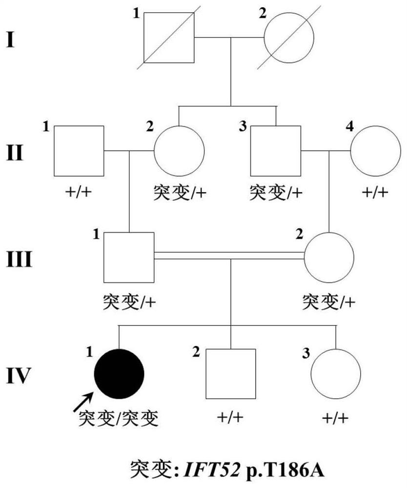 A pathogenic mutation of Leber's congenital amaurosis and its detection reagent