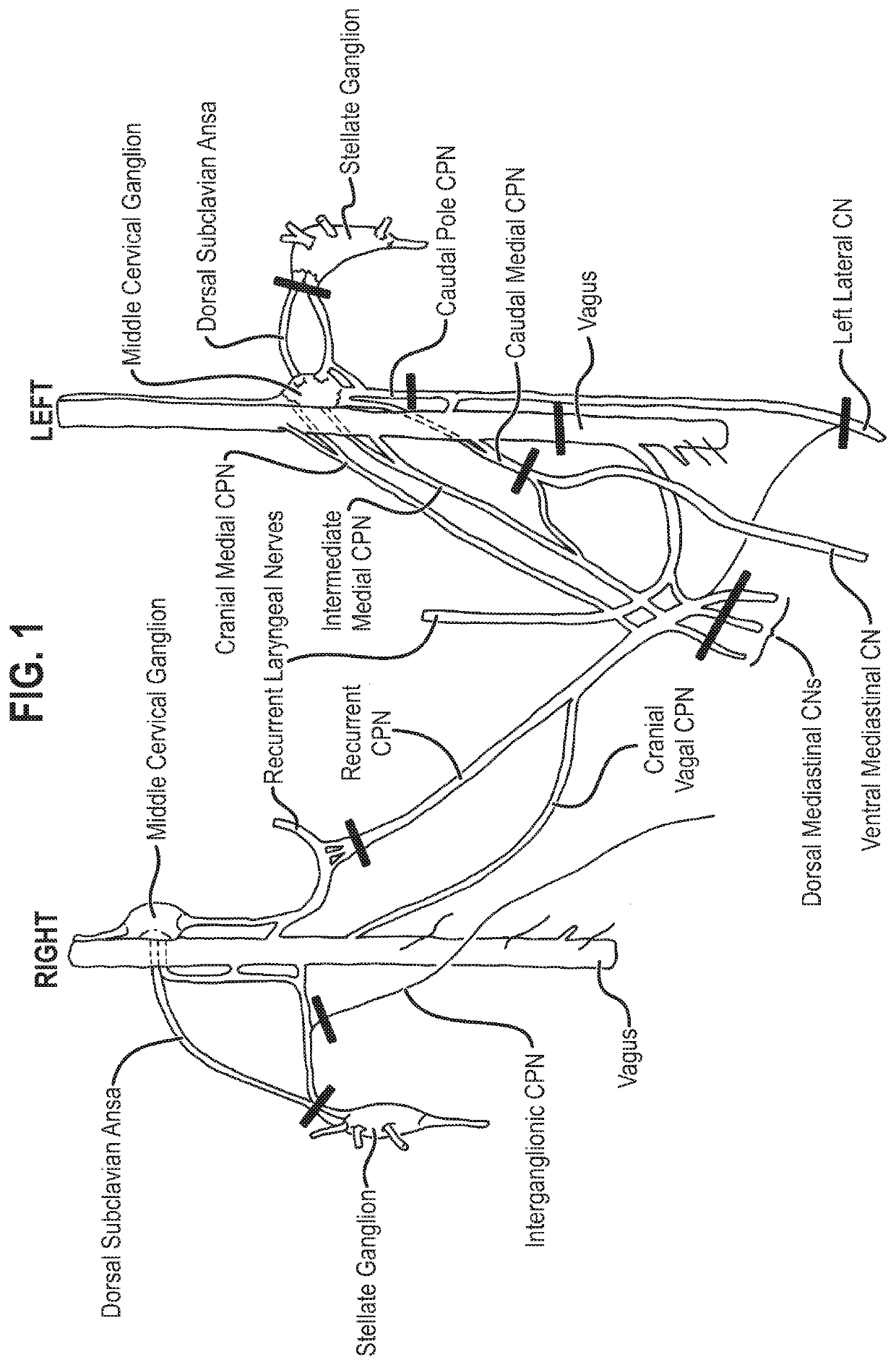 Treatment and prevention of cardiac dysfunction