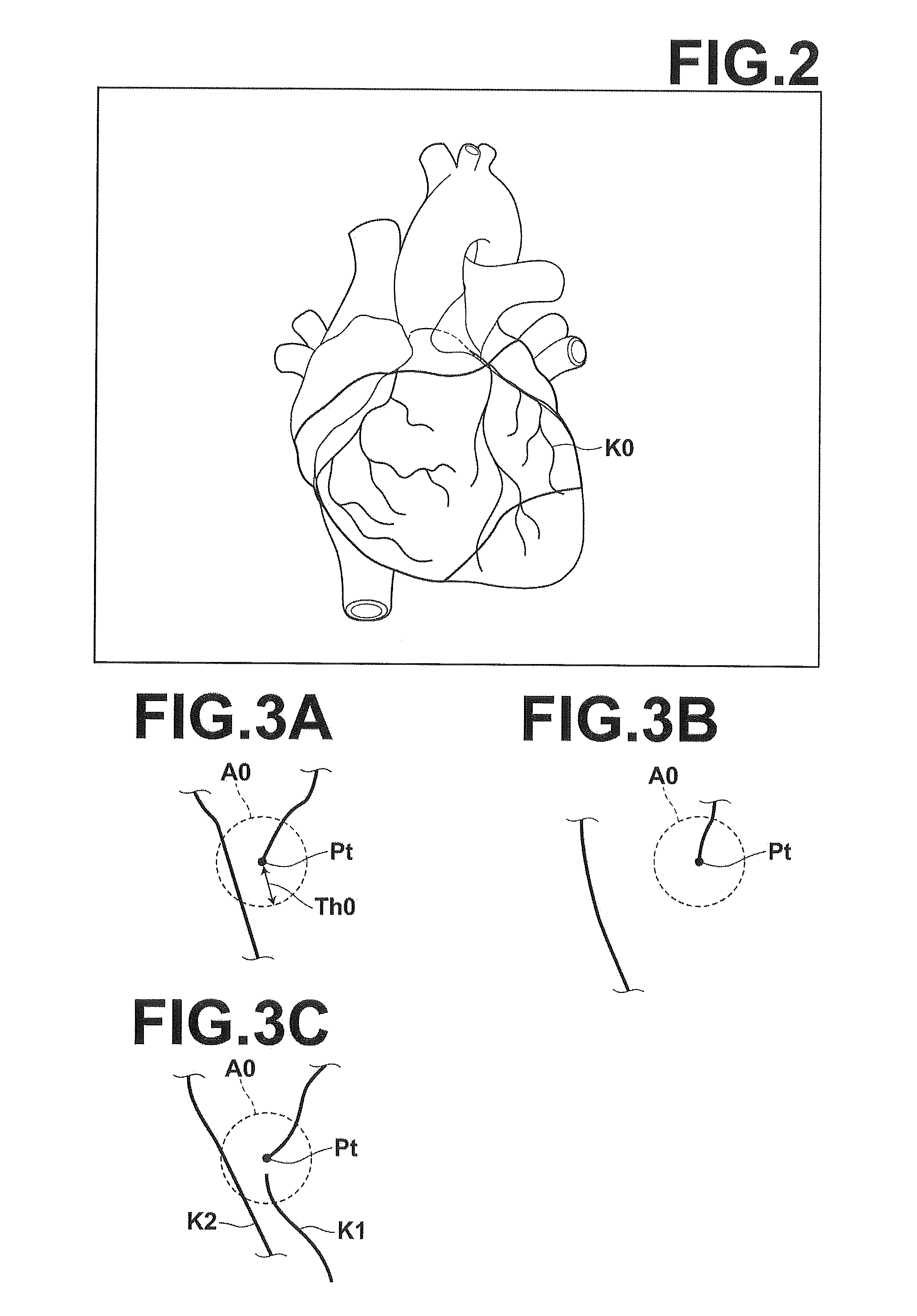 Device, method and program for searching for the shortest path in a tubular structure
