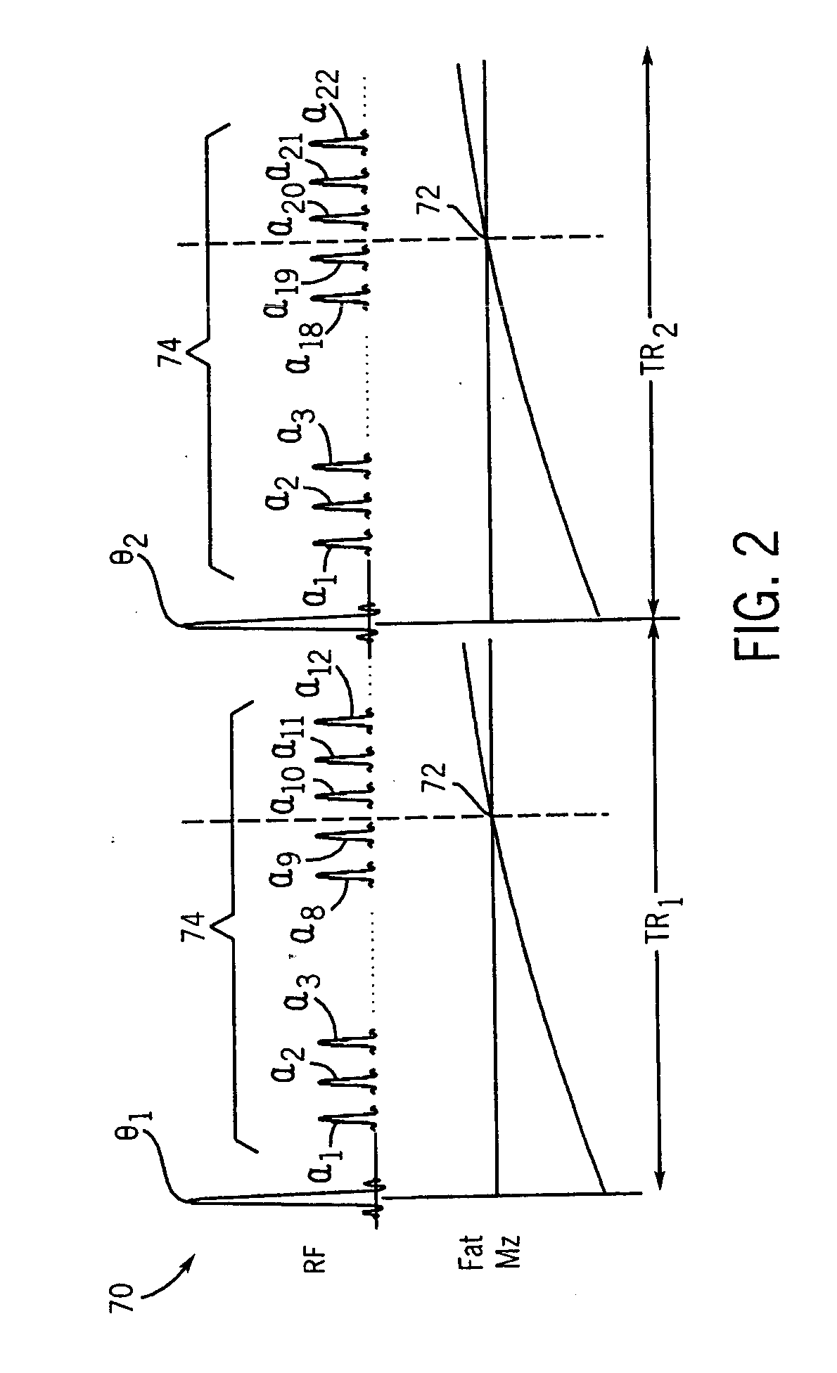 Method and apparatus of gradient echo imaging with on-the-fly optimization of tissue suppression