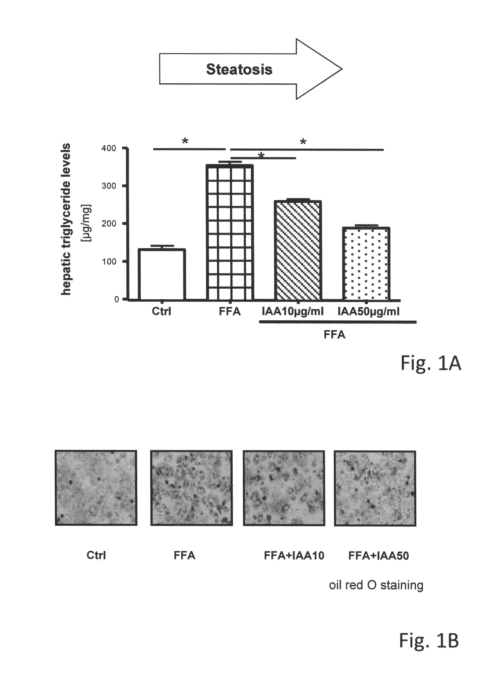 Method for preventing and/or treating the formation of injury of liver and oral composition for use in such method