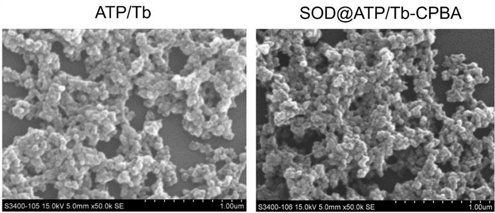 Preparation method and application of enzyme-integrated rare earth coordination polymer
