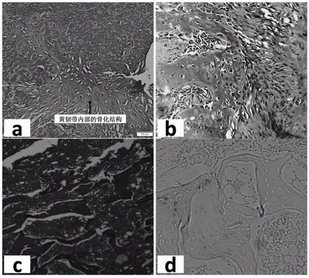 Building method for yellow ligament ossification animal model