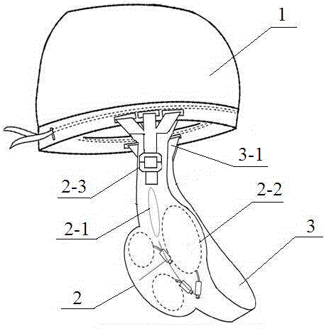 Parotid gland post-operation pressure bandaging device
