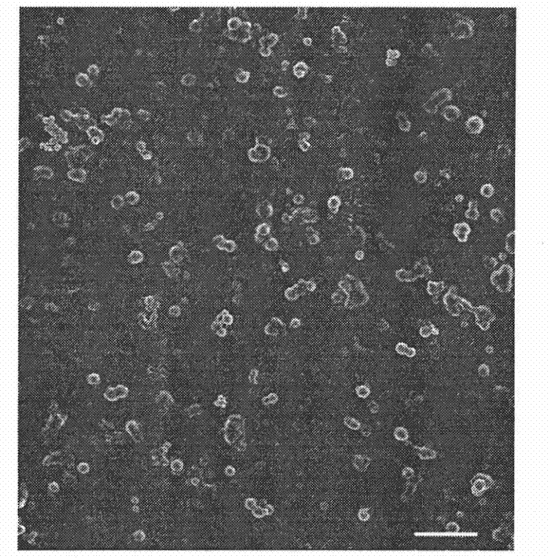 Method for preparing in-situ therapeutic substance-loaded microcapsules