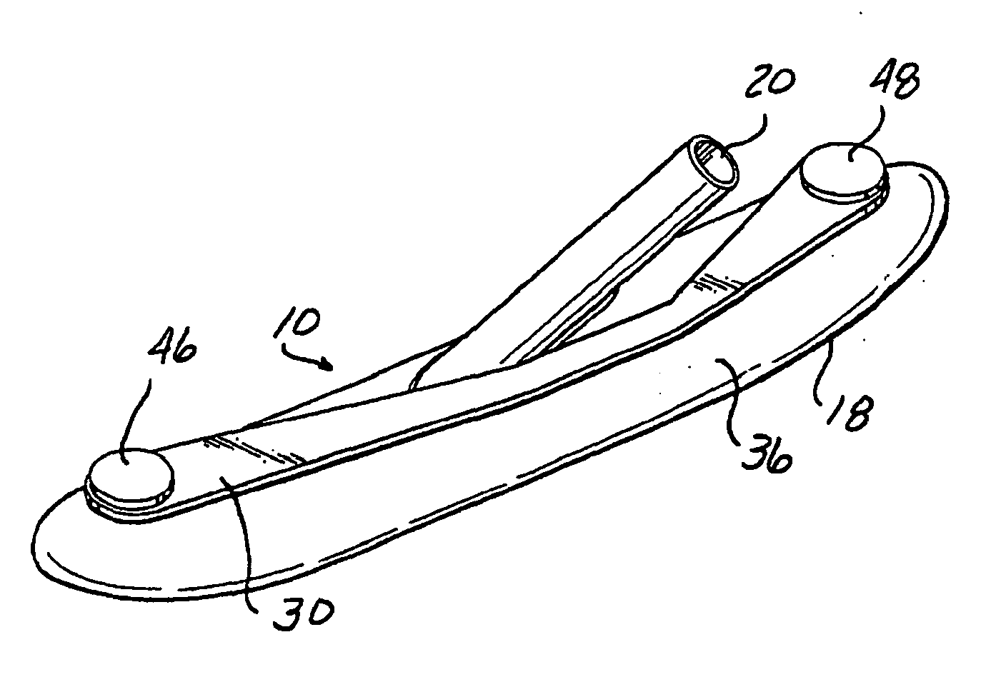 Stable aortic blood pump implant