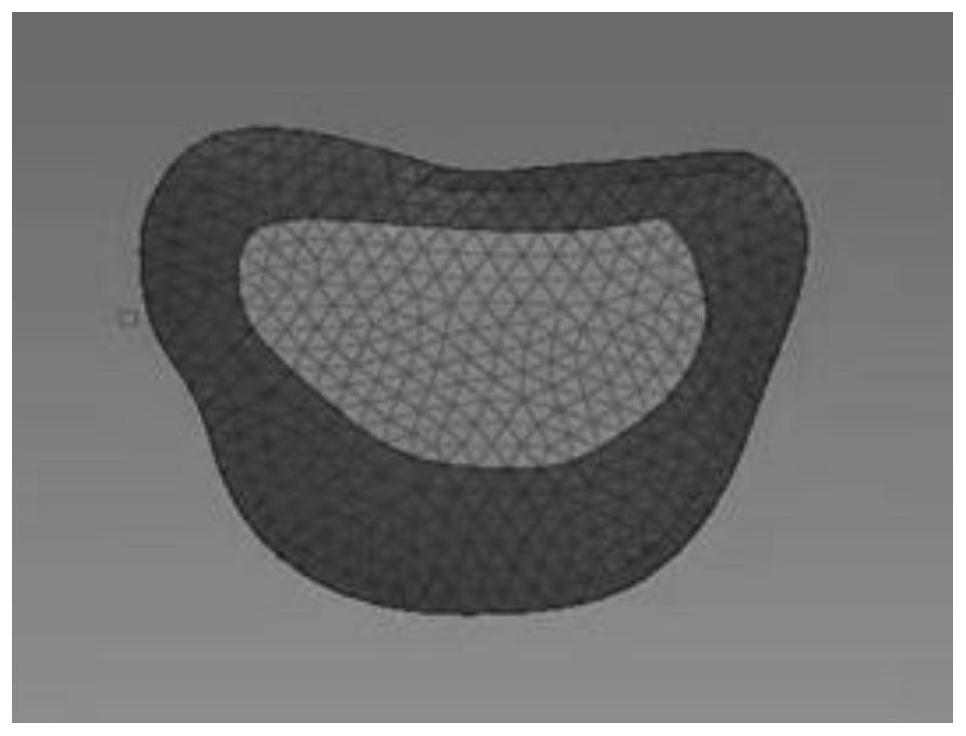 Spine near-end boundary angle operation optimization method based on finite elements and machine learning