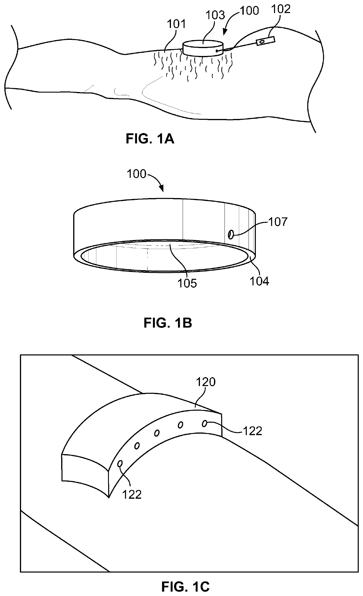 Systems for treating tissue