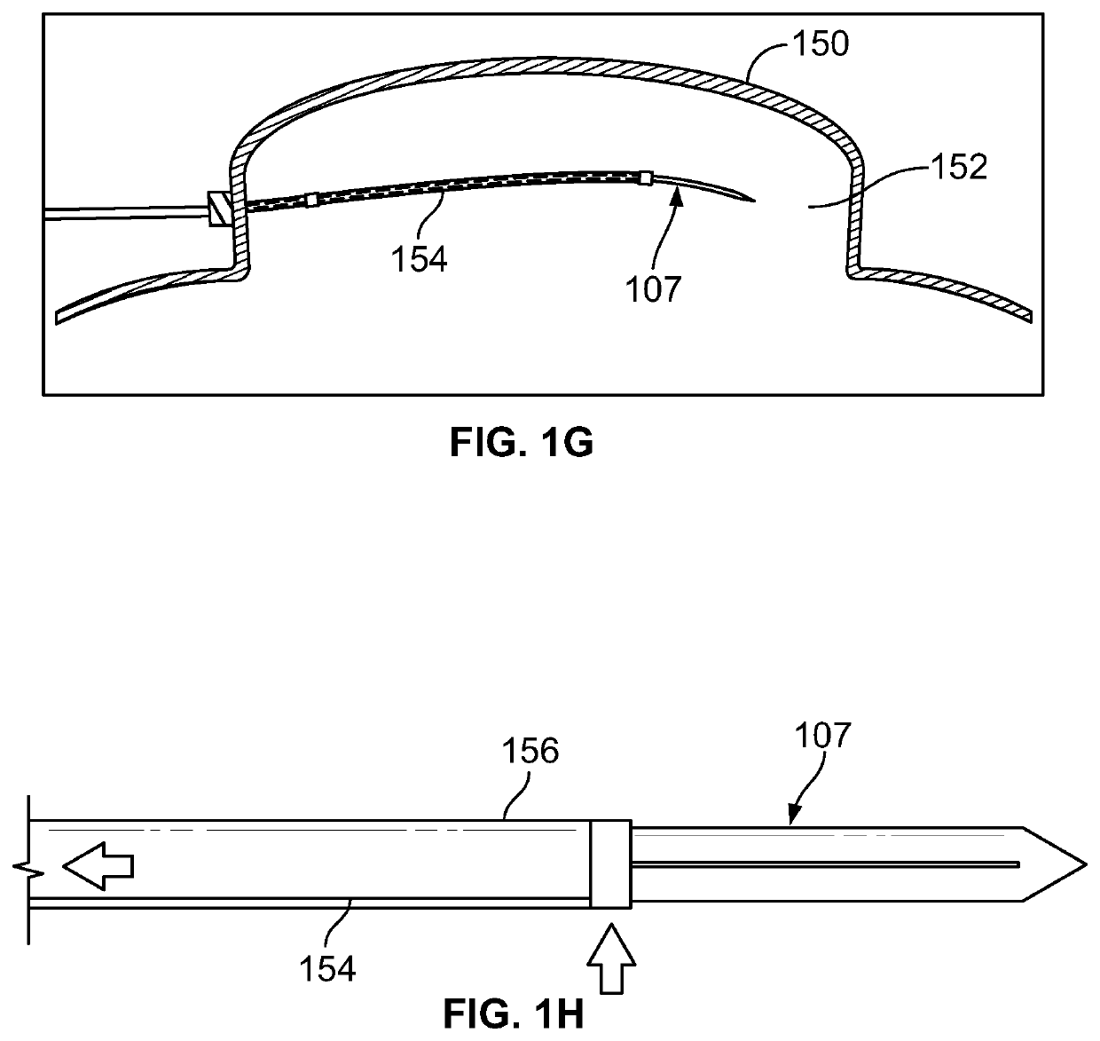 Systems for treating tissue