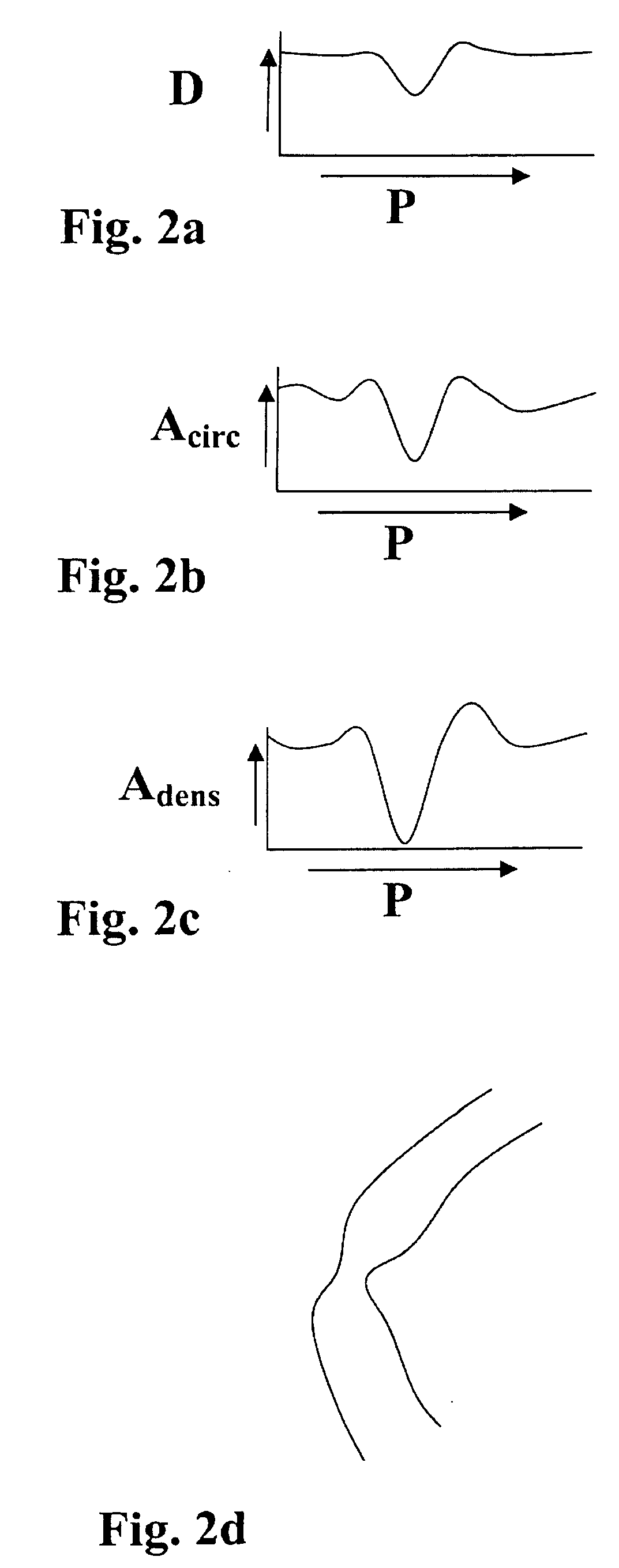 Method, apparatus and computer program for contour detection of vessels using x-ray densitometry