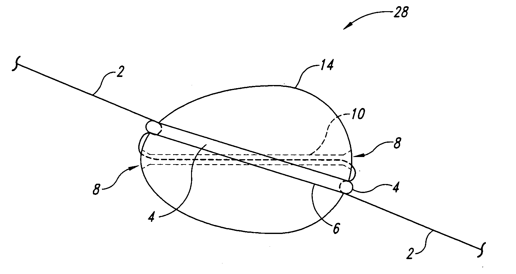 Reversibly disengaging slidable strike indicator, positioning system, and method of using same