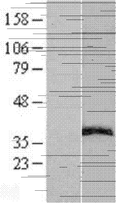 Anti ERCC1 monoclonal antibody 2E12 and application