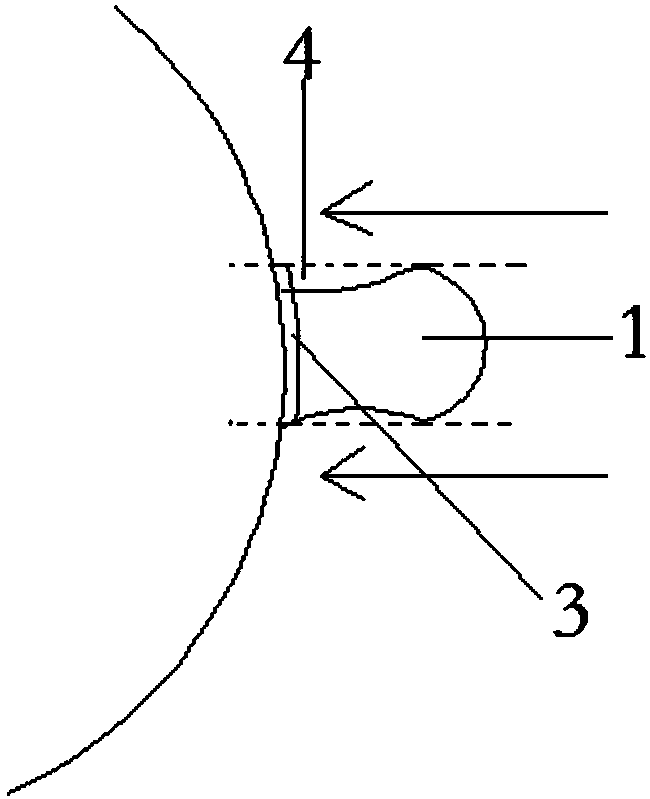 Method for dynamic seamless breast augmentation surgery without blood bags, bandages or suture removal